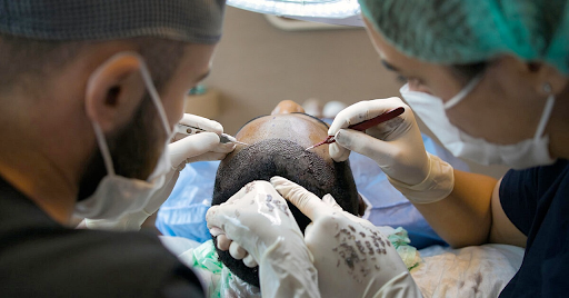 Hair Transplant