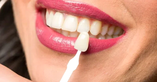 How A Dentist in Solihull Can Boost Your Dental Confidence