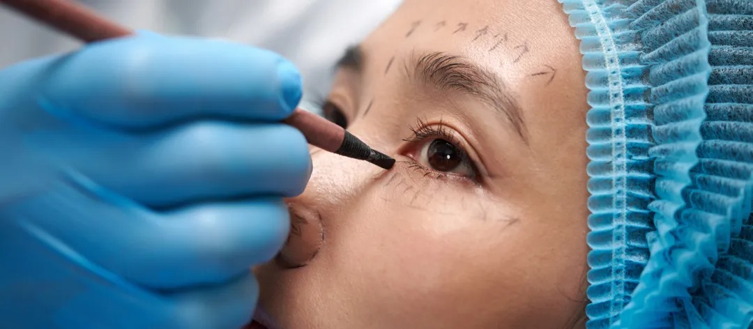 South Korea Plastic Surgery The Global Capital of Aesthetic Excellence