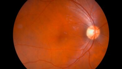 Through a Glass, Darkly Tracing the Pathways of Retinal Disease Modelling