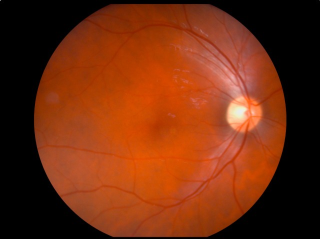 Through a Glass, Darkly Tracing the Pathways of Retinal Disease Modelling